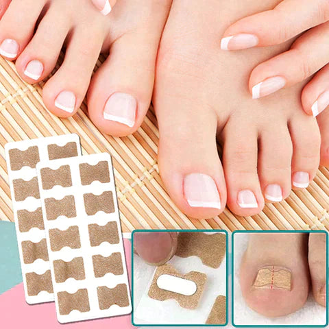 Nail Correction Patches