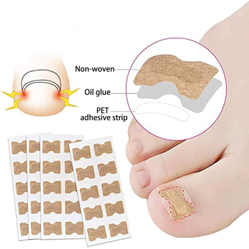 Nail Correction Patches