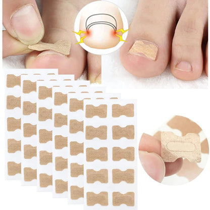 Nail Correction Patches